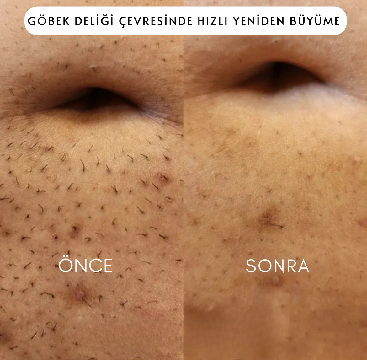 5' li Bayan Traş Makinesi Seti