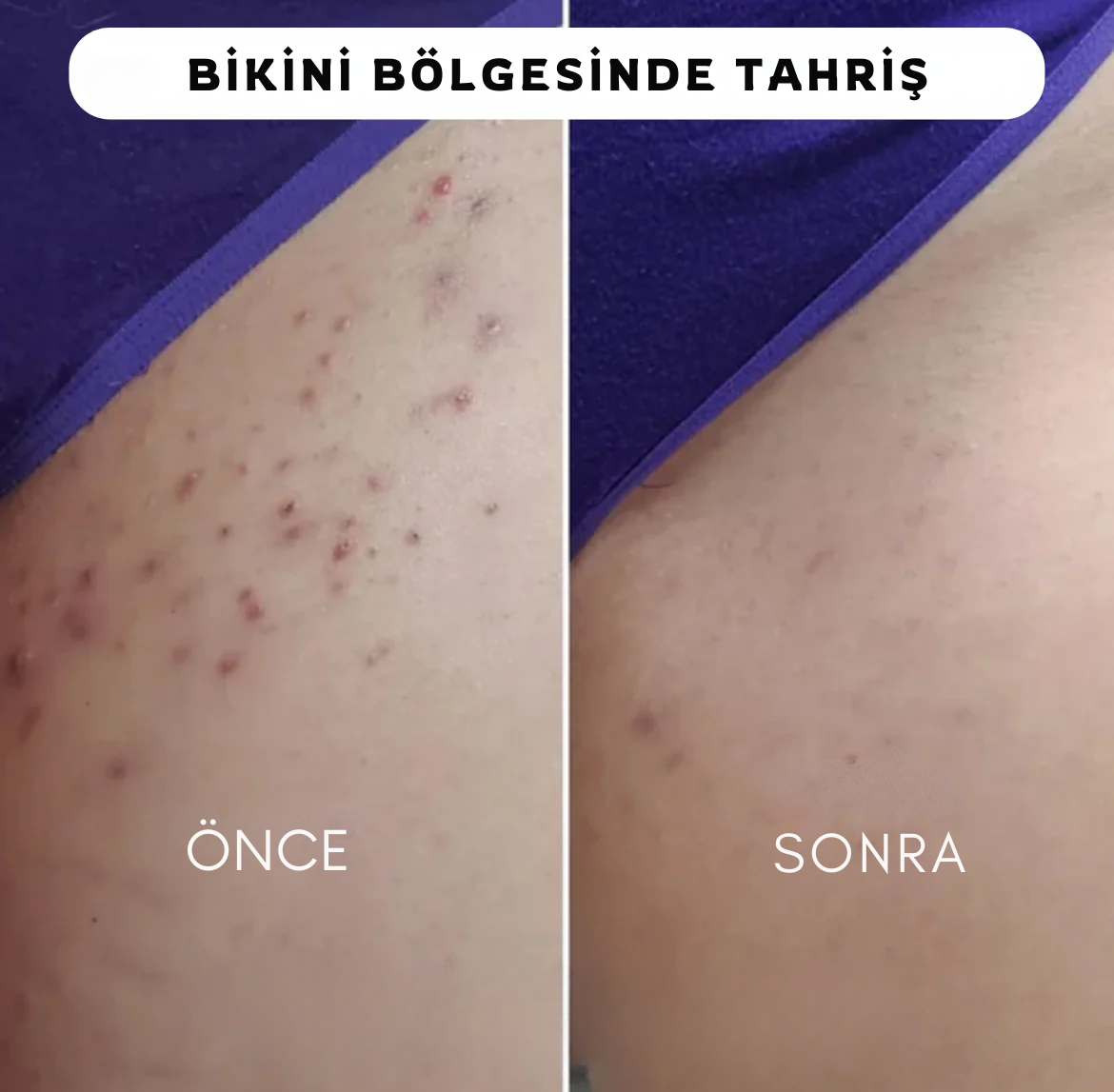 5' li Bayan Traş Makinesi Seti