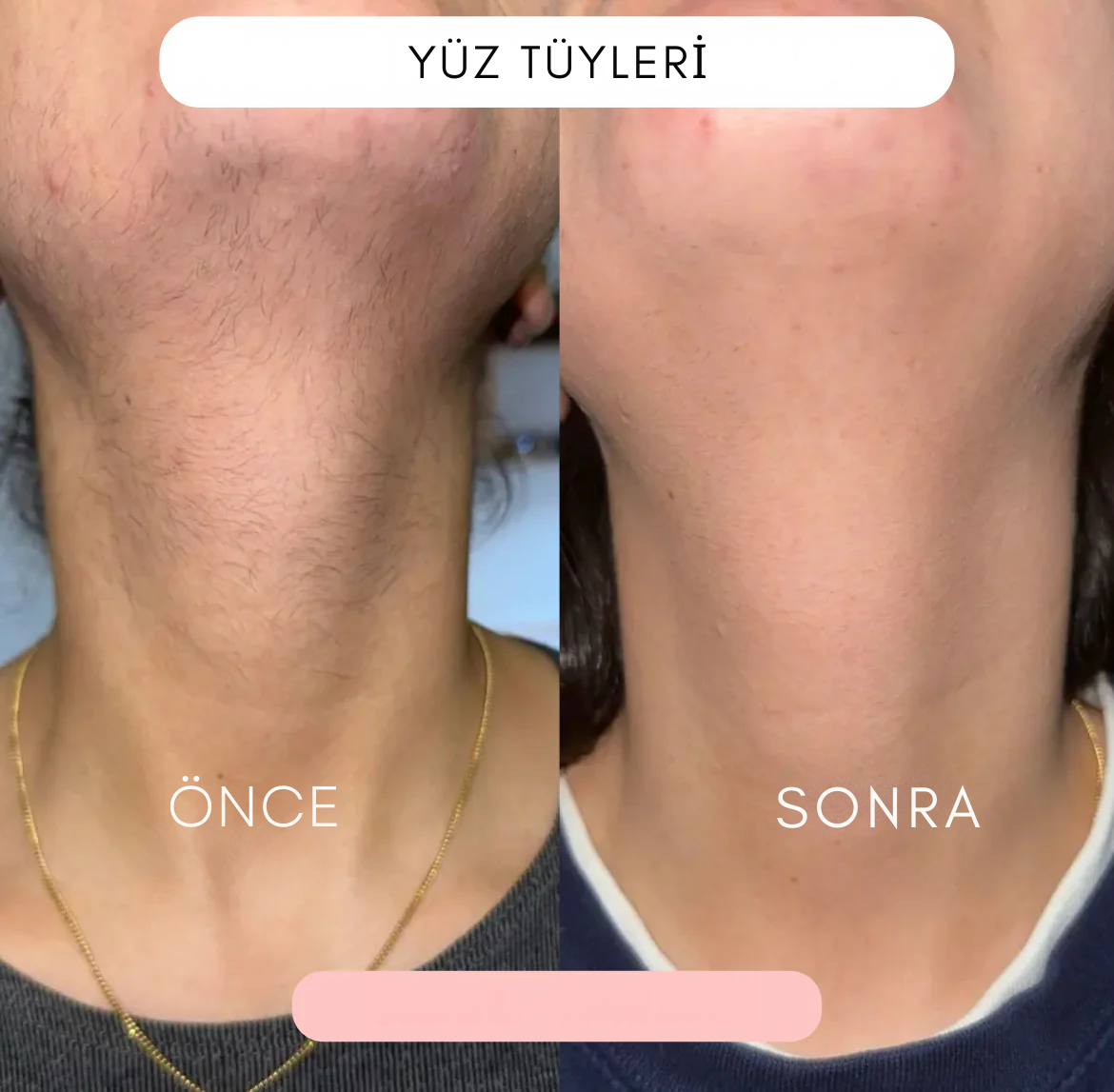 5' li Bayan Traş Makinesi Seti