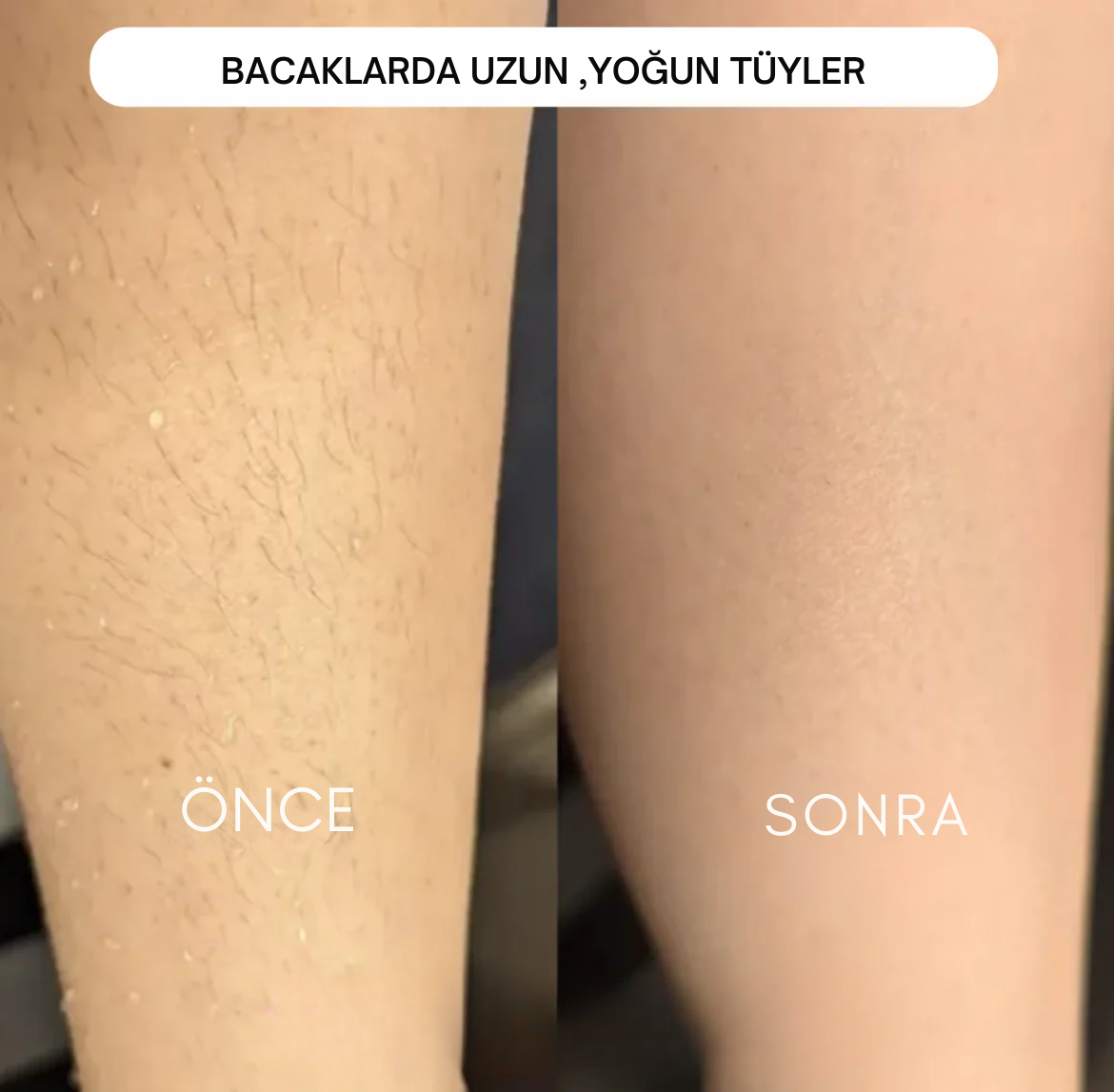 5' li Bayan Traş Makinesi Seti