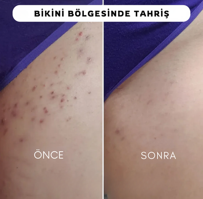 5' li Bayan Traş Makinesi Seti